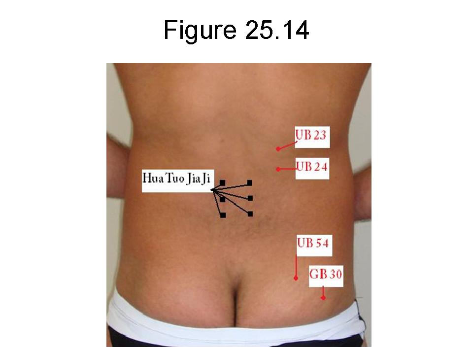 Huan zhong acupuncture point