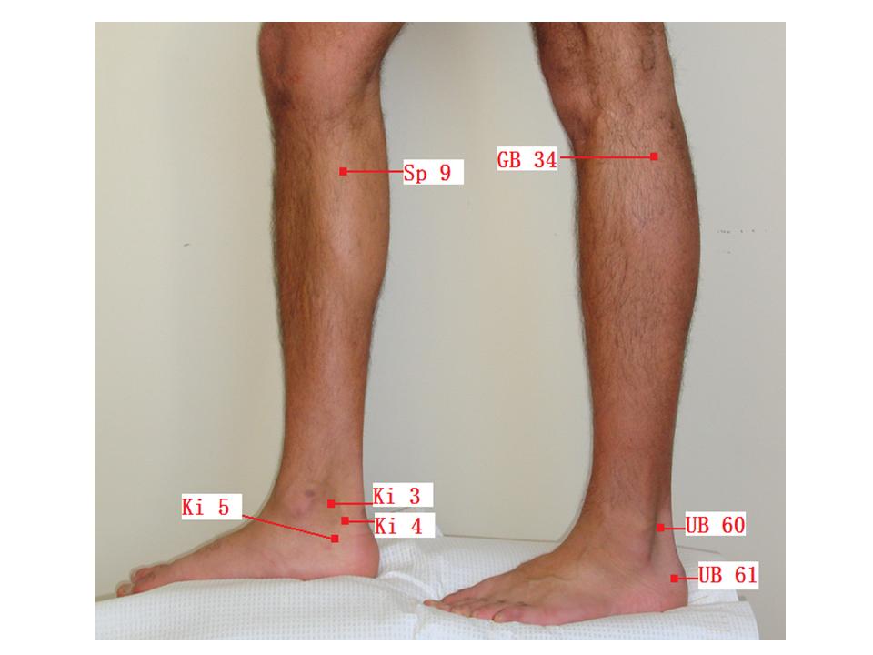 Tendonitis as related to Acupuncture Pictures