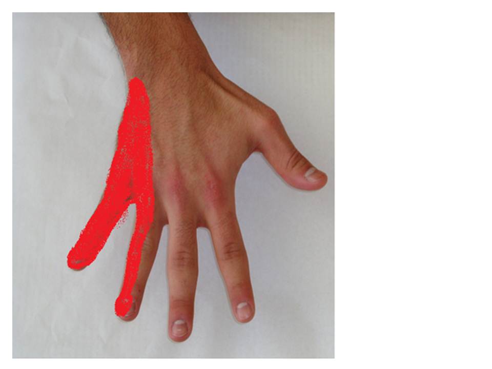 36. Acupuncture and Wrist Pain After Bike RidingUlnar Nerve