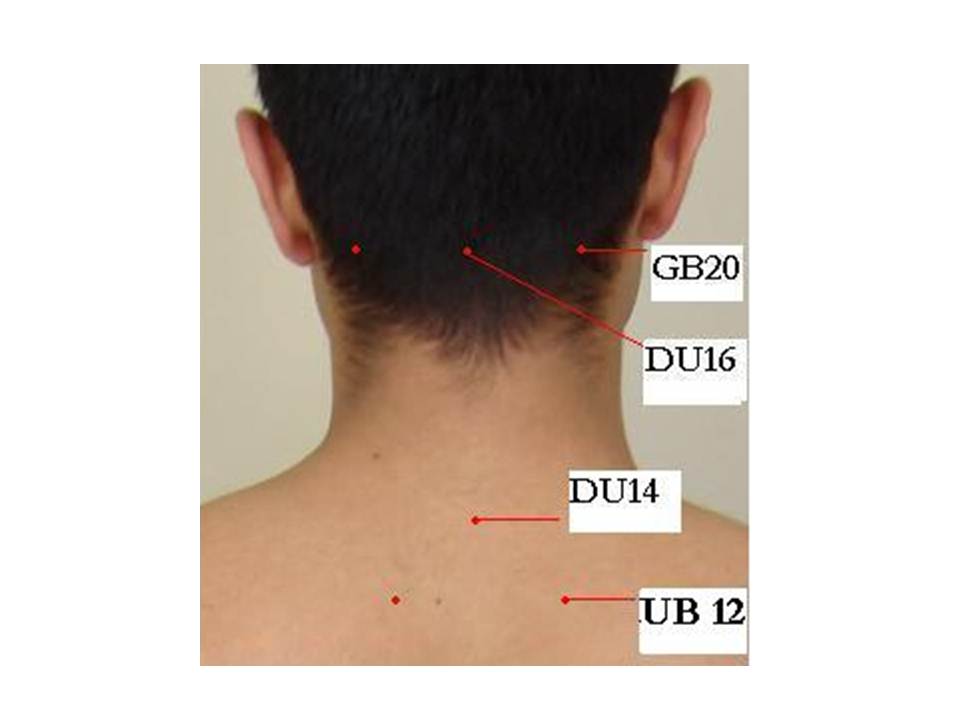 43. Acupuncture and Insomnia « Jun Xu, M.D. (203) 6377720, 1171 E