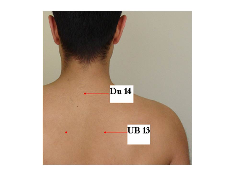 43. Acupuncture and Insomnia « Jun Xu, M.D. (203) 6377720, 1171 E