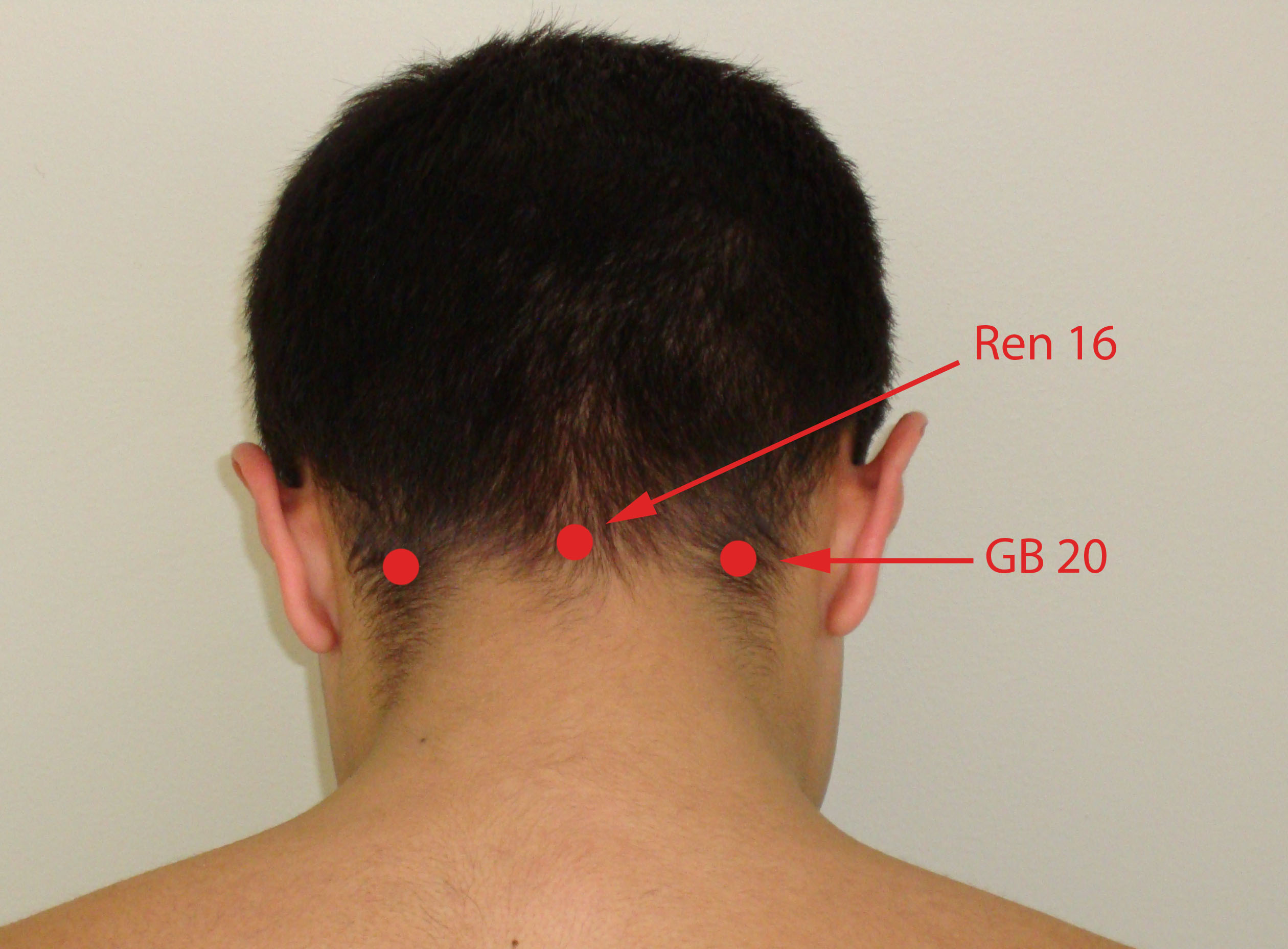 Peripheral Polyneuropathy Jun Xu M D 203 637 7720 1171 E Putnam Ave Greenwich Ct 06878