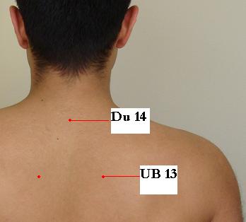 https://www.drxuacupuncture.co/wp-content/uploads/2009/06/back_pic2.jpg