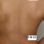 https://www.drxuacupuncture.co/wp-content/uploads/2009/07/5-150x150.jpg
