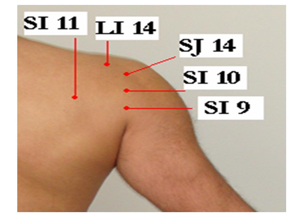 17. Acupuncture and Frozen ShoulderShoulder Pain 1 Jun Xu, M.D. R.M