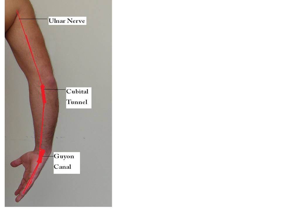 36. Acupuncture and Wrist Pain After Bike RidingUlnar Nerve
