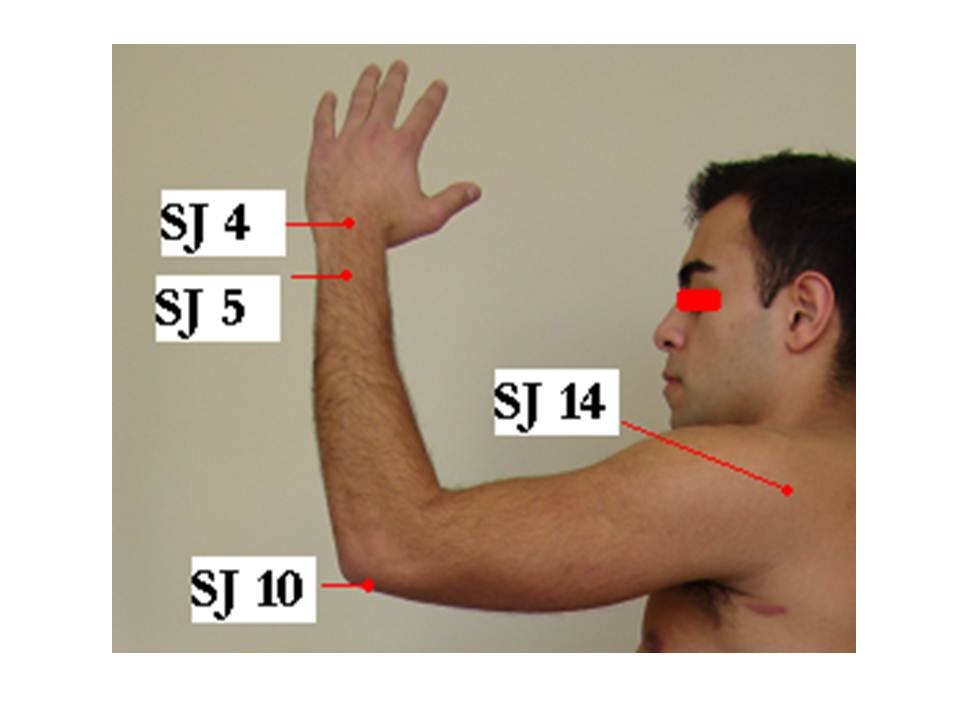 42. Acupuncture and Postchemotherapy Syndrome Jun Xu, M.D. R.M.A.C