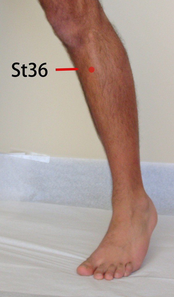 48. Acupuncture and Multiple Sclerosis Jun Xu, M.D. R.M.A.C